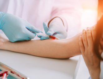 DCU-led blood test study could boost breast cancer treatment